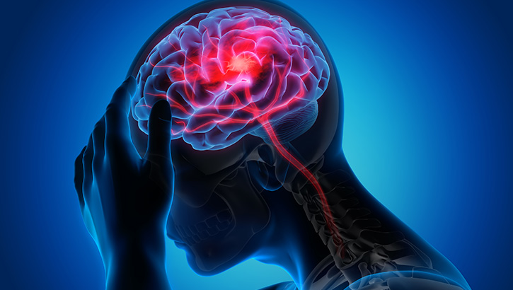 Image of DHA Has Assessment Tool for Sudden, Unexplained Sensory Events.