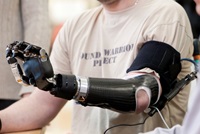 Prosthetic arm