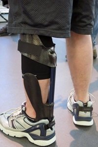 Prosthetic leg