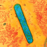 Anthrax bacteria