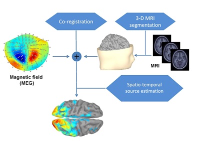 MEG Data Analysis Workflow