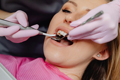 Woman lies in dentist chair as a hygienist uses dental tool.