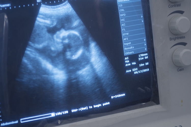 Image of Syphilis Cases Among Pregnant Women and Newborns in the Military Health System, 2012–2022.