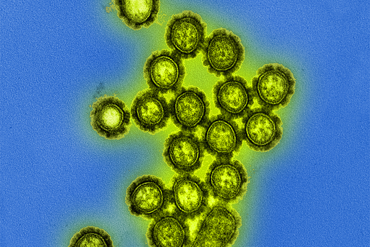 Image of Photo2_ToC_CDCPHIL18156.