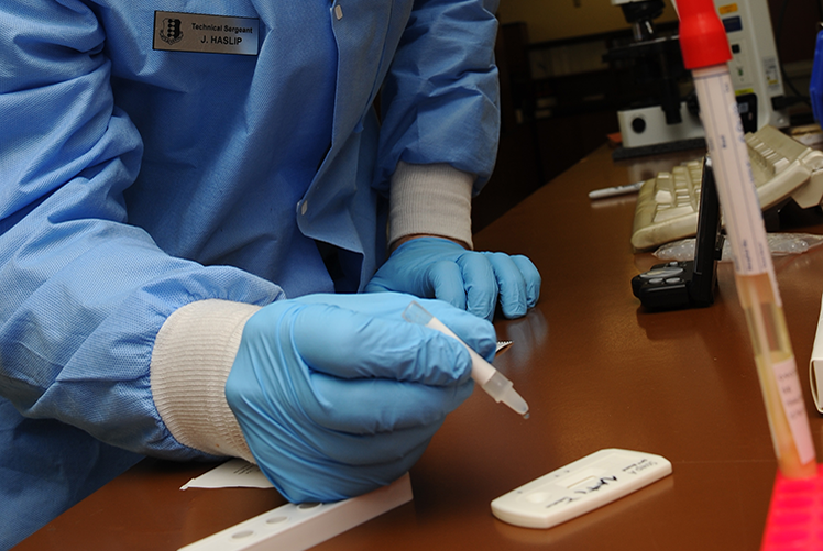 Image of A specimen is tested for mononucleosis at the medical clinic on Ellsworth Air Force Base, South Dakota (U.S. Air Force photo).