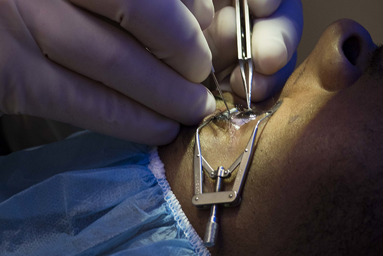 Image of SAN DIEGO (April 6, 2017) Cmdr. John Cason, program director Navy Refractive Surgery, performs the second Small Incision Lenticular Extraction (SMILE) procedure at Naval Medical Center San Diego. The SMILE procedure is the latest advancement in refractive surgery for correcting myopia or nearsightedness. (U.S. Navy photo by Mass Communication Specialist 1st Class Elizabeth Merriam/Released).