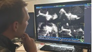 A doctor reading an echocardiogram. 