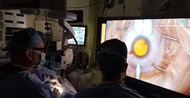 A physician performs cataract surgery using heads up display.